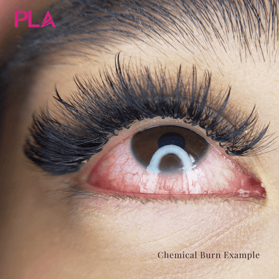 3 Lash Extensions Risks: Chemical Burns, Allergic Reactions & Abrasions