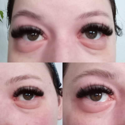 What A Real Allergic Reaction To Lash Extensions Looks Like